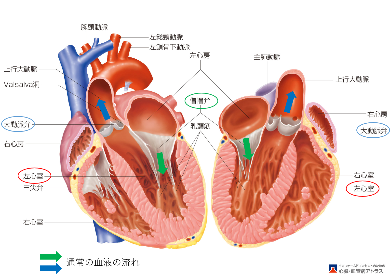 心臓弁膜症についてのわかりやすい説明